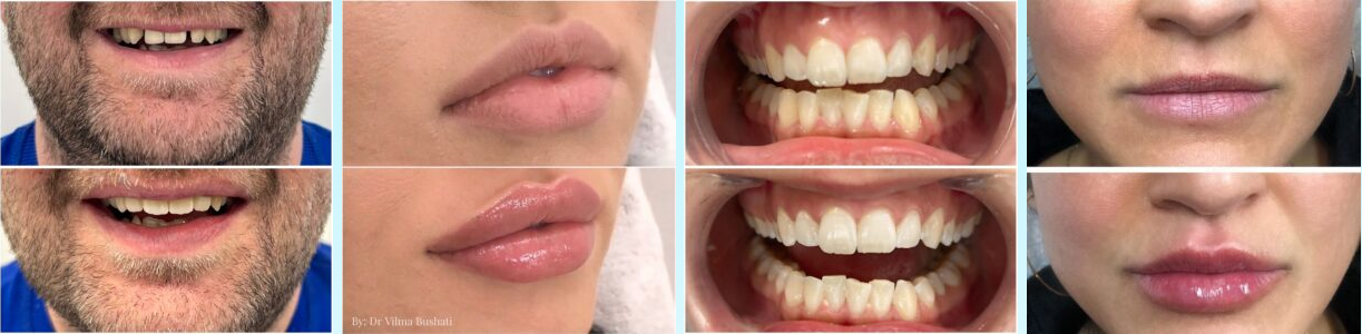Happy Ini Dent patients